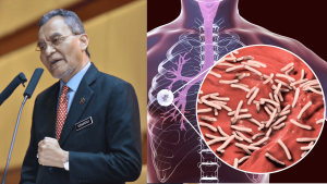 tb malaysia cases spike