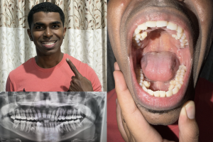 malaysia man teeth guinness world record